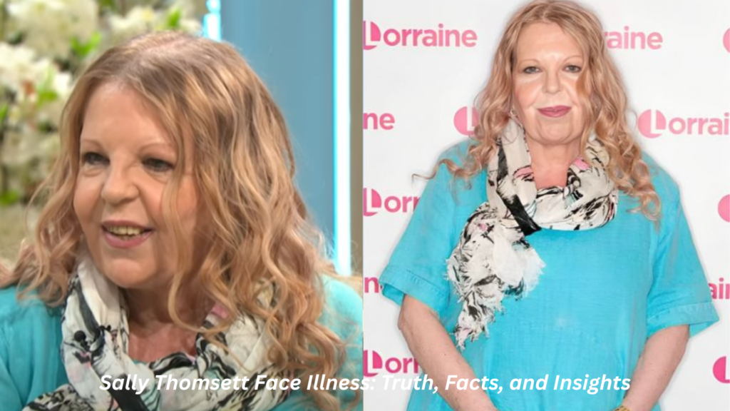 sally thomsett face illness