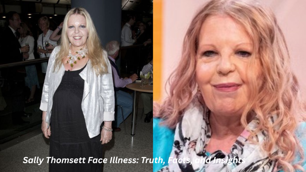 sally thomsett face illness