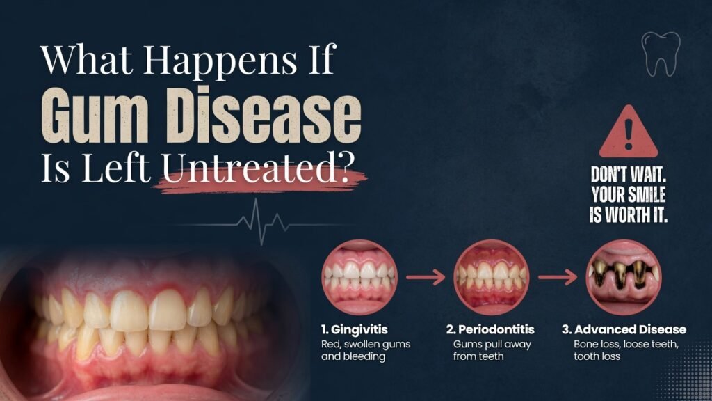 How to Cure Gum Disease Without a Dentist